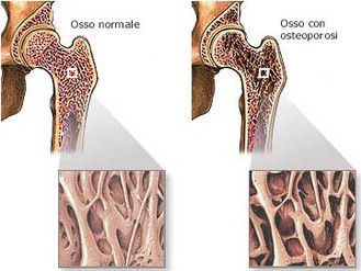 Essendo diventato il rinforzo di una potenzialità