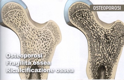Limpotenza come trattare e che